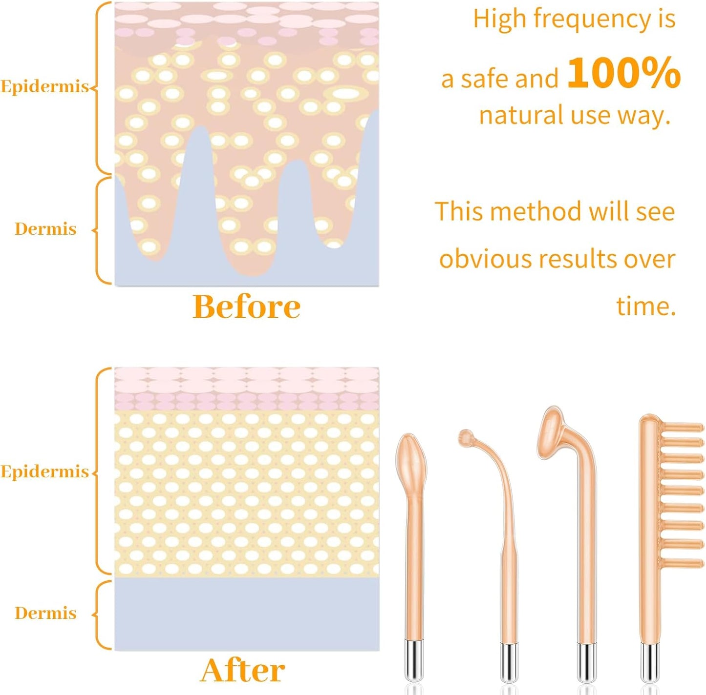 Azra High Frequncy Portable Handheld Facial Skin Care Wand Machine