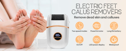 Babyverse Automatic Foot Callus Remover – Rechargeable, Waterproof, 3 Heads