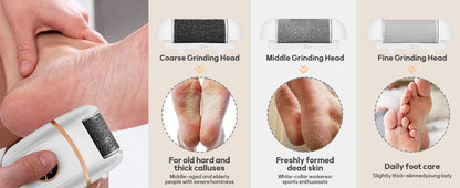 Babyverse Automatic Foot Callus Remover – Rechargeable, Waterproof, 3 Heads