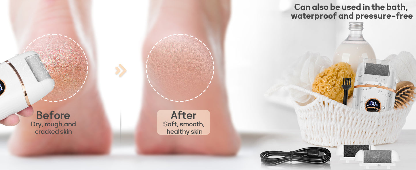 Babyverse Automatic Foot Callus Remover – Rechargeable, Waterproof, 3 Heads