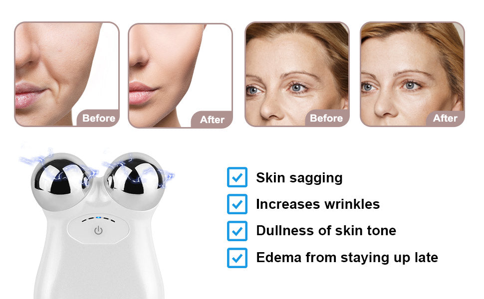 Azra Microcurrent Facial Toning & Sculpting Tool | MY DERMA DREAM