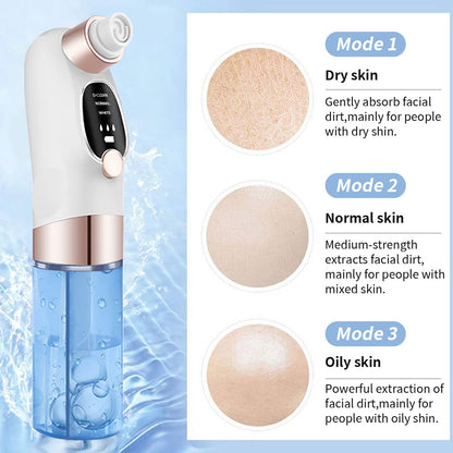 Azra Aqua Vacuum Pore Cleaner | Blackhead Remover