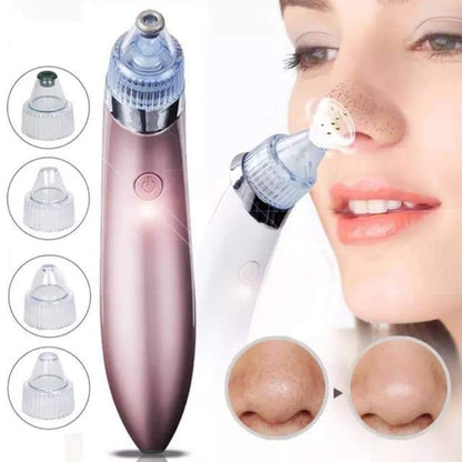 5 in 1 Black Head  Remover xn 8030