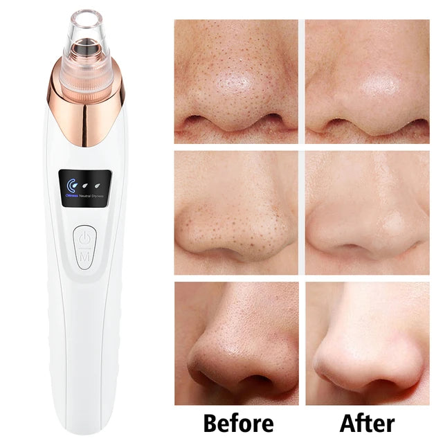 5-in-1 Electric Facial Cleanser & Massager | Azra.pk