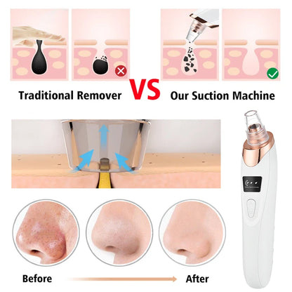 5-in-1 Electric Facial Cleanser & Massager | Azra.pk