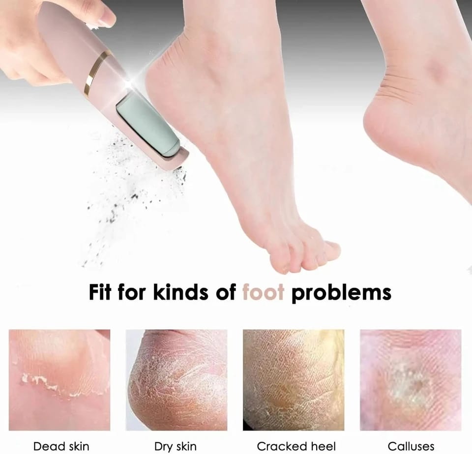 Rechargeable Electric Foot Callus Remover | Azra.pk