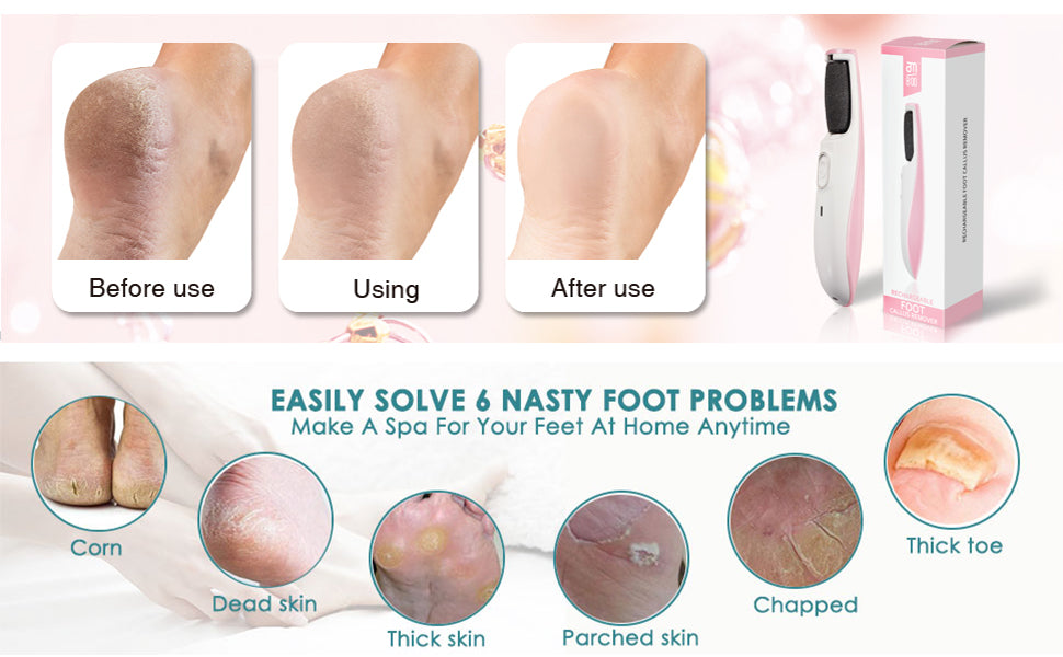 Rechargeable Electric Foot Callus Remover | Azra.pk