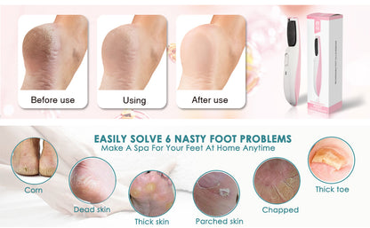 Rechargeable Electric Foot Callus Remover | Azra.pk